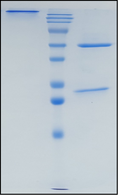 (Lenzilumab)Biosimilar Reference Antibody