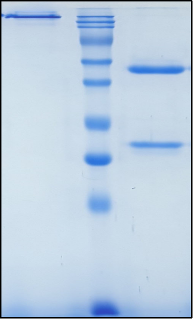 (Levilimab)Biosimilar Reference Antibody