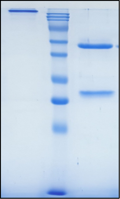 (Libivirumab)Biosimilar Reference Antibody