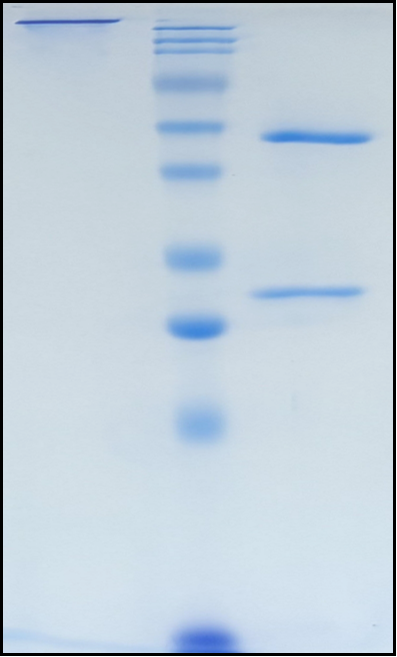 (Lipustobart)Biosimilar Reference Antibody