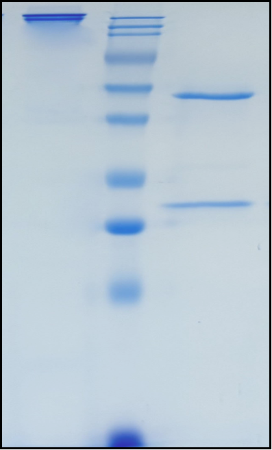 (Manfidokimab)Biosimilar Reference Antibody