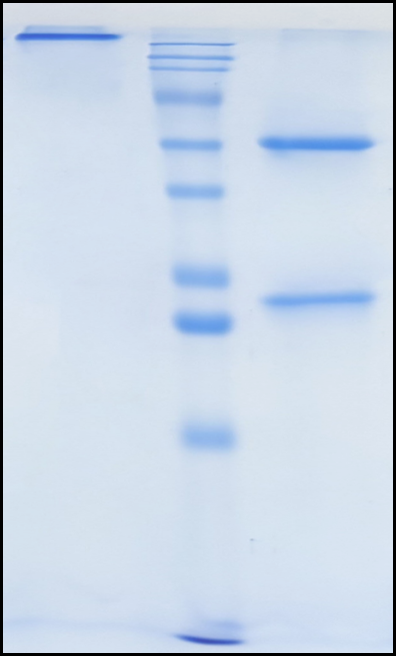 (Nadecnemab)Biosimilar Reference Antibody