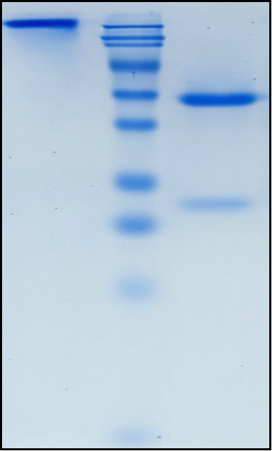 (Narnatumab)Biosimilar Reference Antibody
