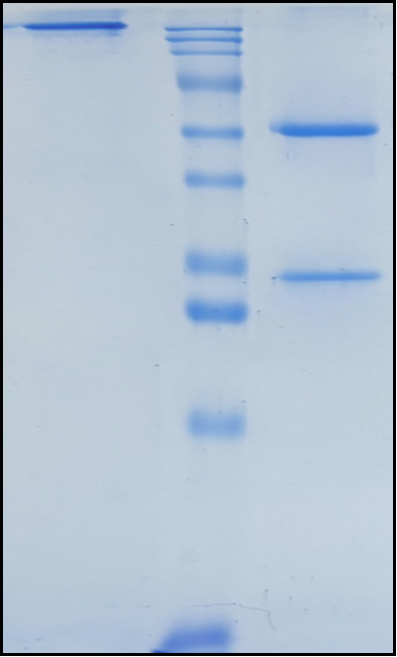 (Narsoplimab)Biosimilar Reference Antibody