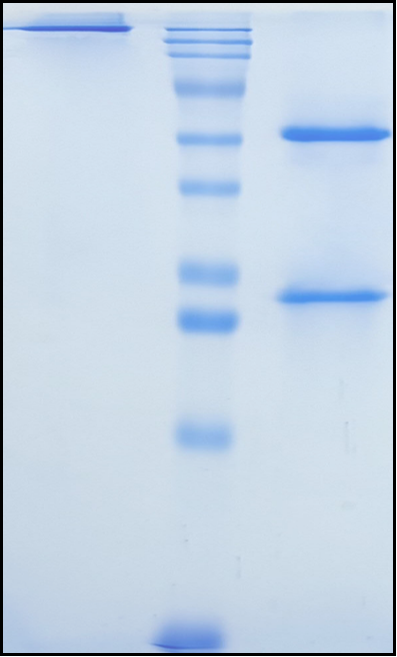 (Oloctinebart)Biosimilar Reference Antibody