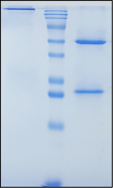 (Olokizumab)Biosimilar Reference Antibody