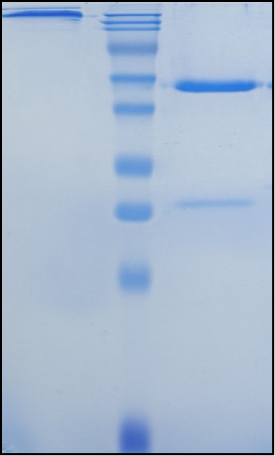 (Orticumab)Biosimilar Reference Antibody