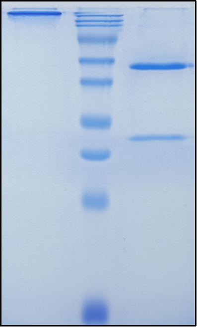(Osemitamab)Biosimilar Reference Antibody