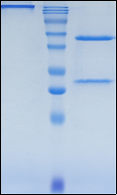 (Ozanezumab)Biosimilar Reference Antibody