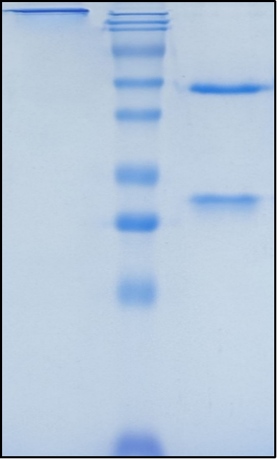 (Pateclizumab)Biosimilar Reference Antibody
