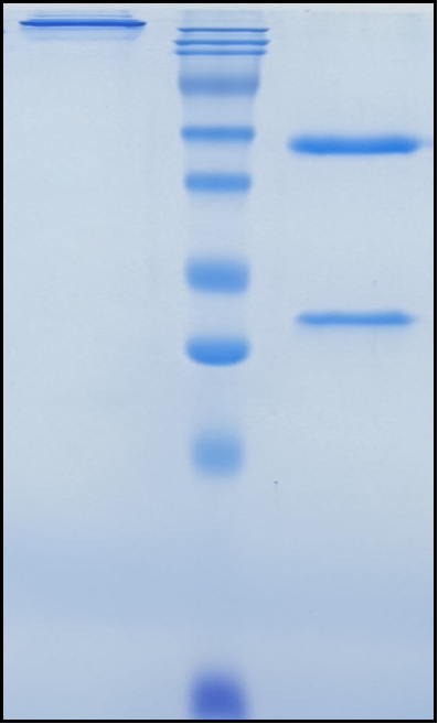 (Perakizumab)Biosimilar Reference Antibody