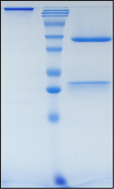 (Picankibart)Biosimilar Reference Antibody