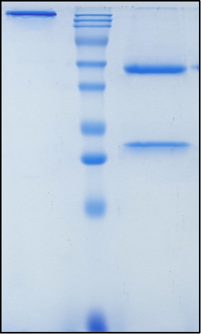 (Plozalizumab)Biosimilar Reference Antibody