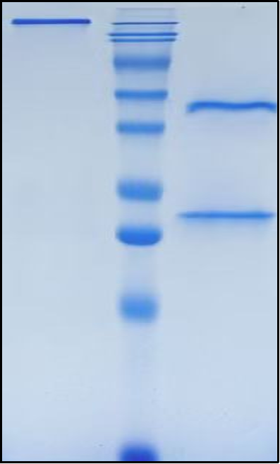 (Ponezumab)Biosimilar Reference Antibody