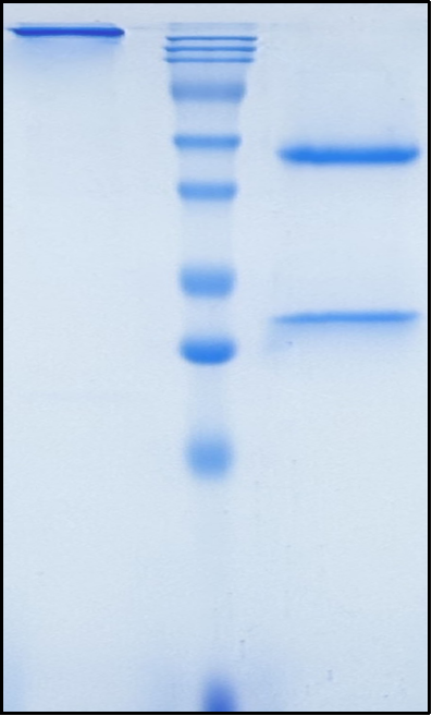 (Posdinemab)Biosimilar Reference Antibody