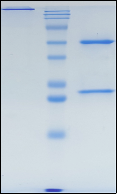(Pozelimab)Biosimilar Reference Antibody