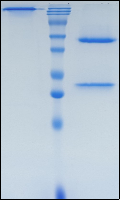 (Prasinezumab)Biosimilar Reference Antibody