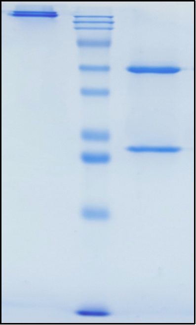 (Quisovalimab)Biosimilar Reference Antibody