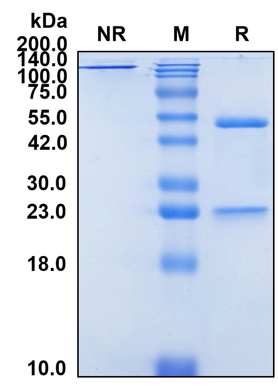 (Racotumomab)Biosimilar Reference Antibody(Idiotope of anti-NeuGc-ganliosides)(CAS NO:946832-34-4)