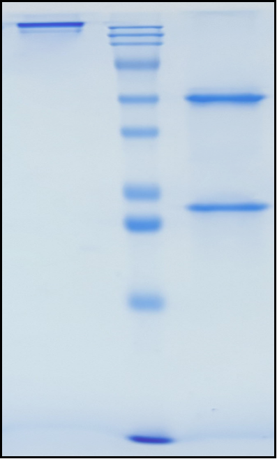 (Rademikibart)Biosimilar Reference Antibody