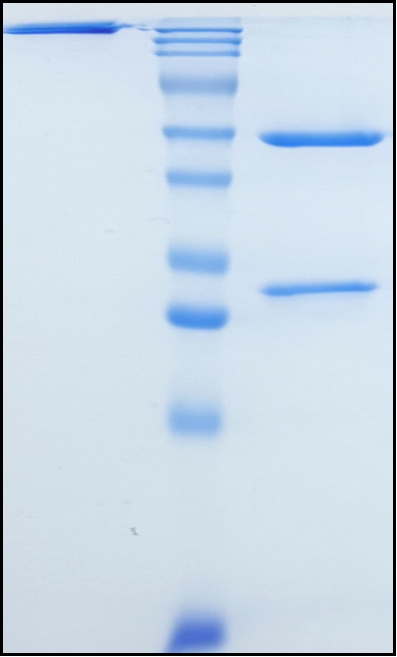 (Refanezumab)Biosimilar Reference Antibody