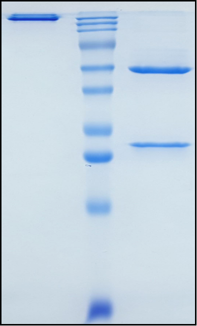 (Remternetug)Biosimilar Reference Antibody