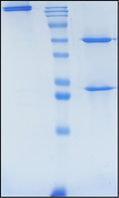 (Reslizumab)Biosimilar Reference Antibody