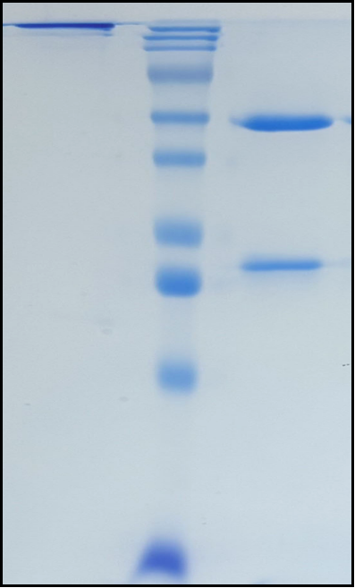 (Rezorstobart)Biosimilar Reference Antibody