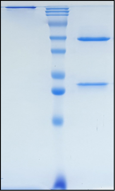 (Rinucumab)Biosimilar Reference Antibody