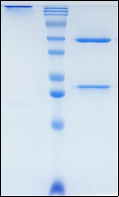 (Risankizumab)Biosimilar Reference Antibody