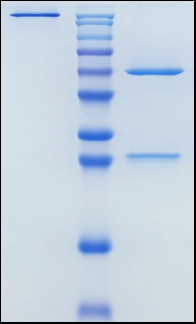 (Romosozumab)Biosimilar Reference Antibody