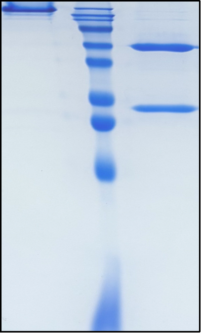 (Ruplizumab)Biosimilar Reference Antibody