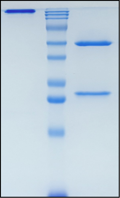 (Secukinumab)Biosimilar Reference Antibody