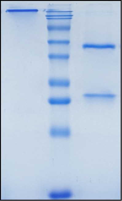 (Setrusumab)Biosimilar Reference Antibody