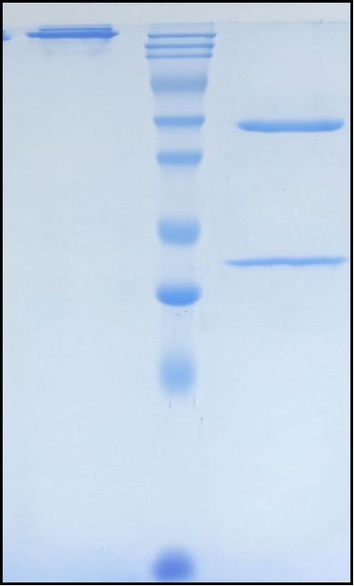 (Solanezumab)Biosimilar Reference Antibody