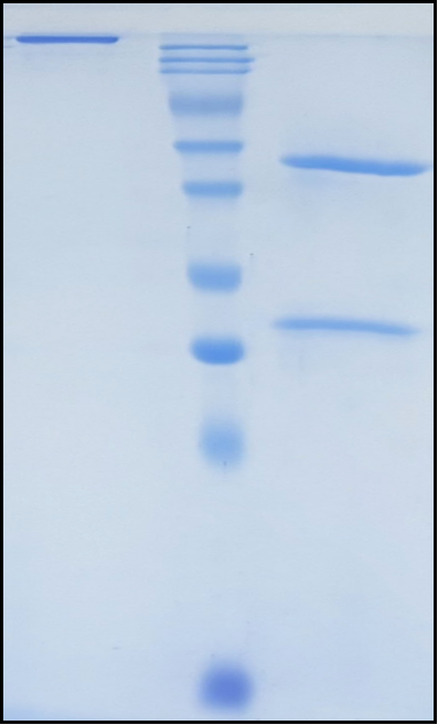 (Sotiburafusp)Biosimilar Reference Antibody