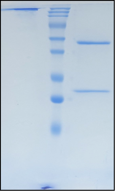(Suciraslimab)Biosimilar Reference Antibody