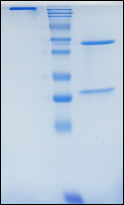 (Tarcocimab)Biosimilar Reference Antibody