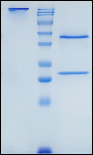 (Tarextumab)Biosimilar Reference Antibody