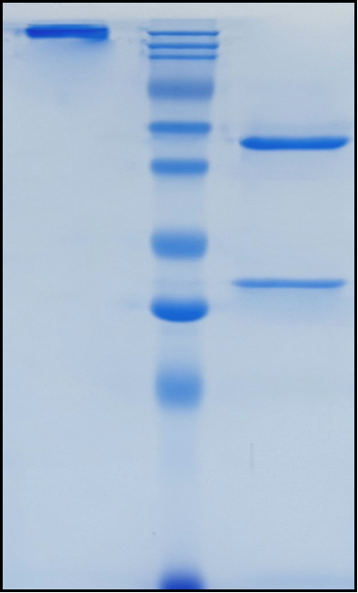 (Tesidolumab)Biosimilar Reference Antibody