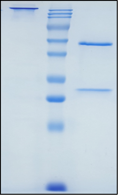 (Tezepelumab)Biosimilar Reference Antibody