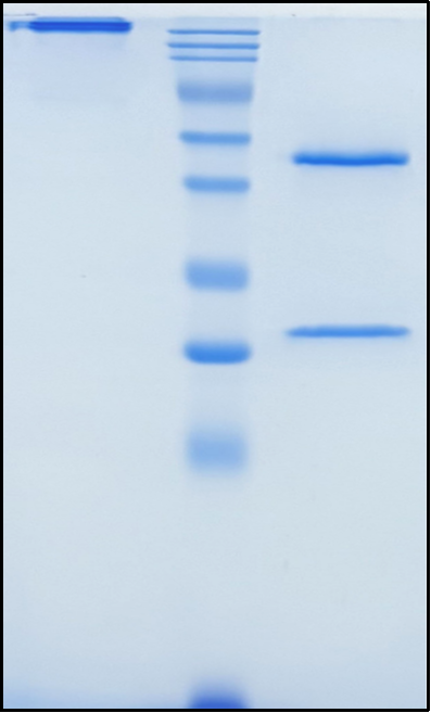 (Timolumab)Biosimilar Reference Antibody