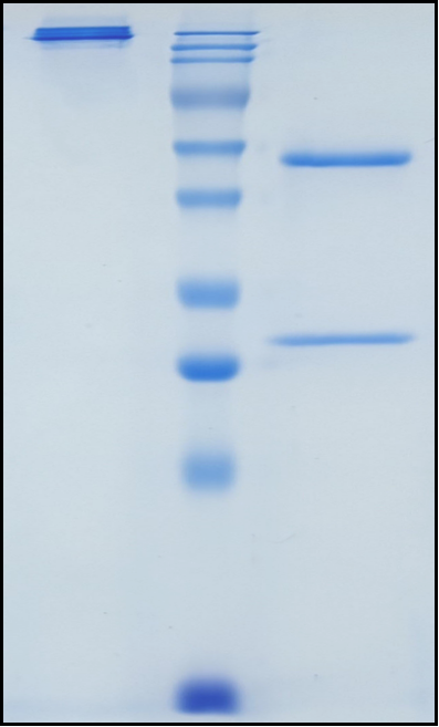 (Tinurilimab)Biosimilar Reference Antibody