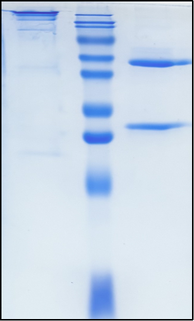 (Tiragolumab)Biosimilar Reference Antibody