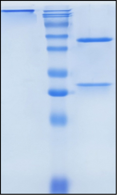 (Tosatoxumab)Biosimilar Reference Antibody