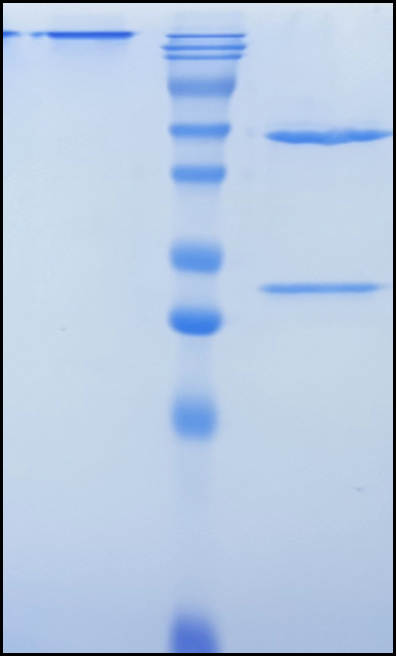 (Tralokinumab)Biosimilar Reference Antibody