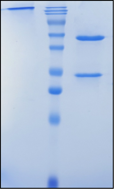 (Ucenprubart)Biosimilar Reference Antibody