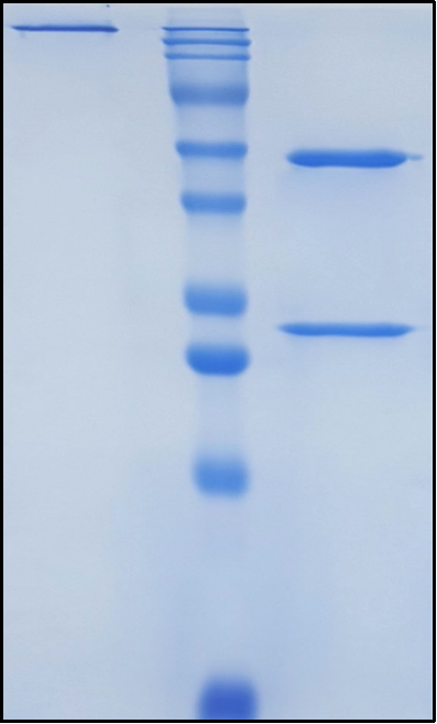 (Ulviprubart)Biosimilar Reference Antibody