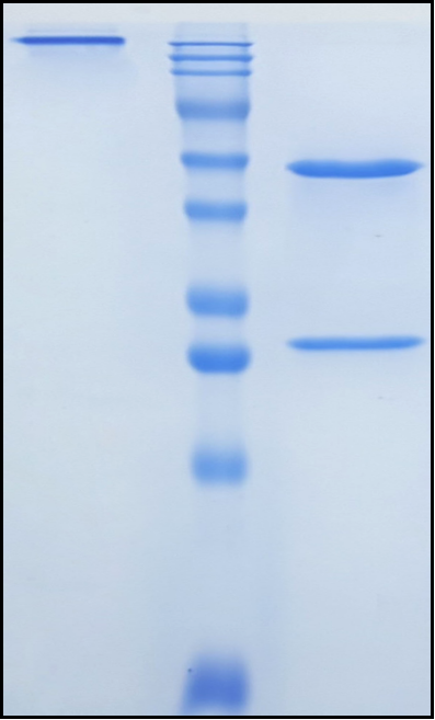 (Upinitatug)Biosimilar Reference Antibody