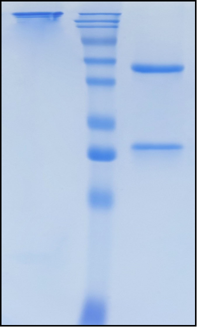 (Usilnetug)Biosimilar Reference Antibody